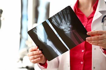 Bone Fracture Specialist Webster TX